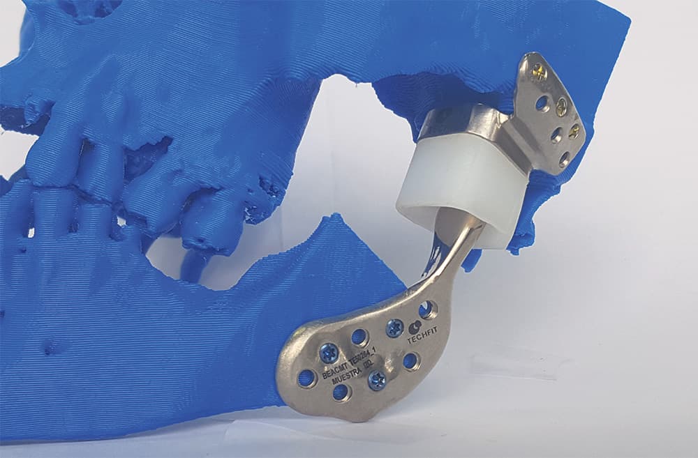 Con impresión 3D obtienen premio de innovación en salud