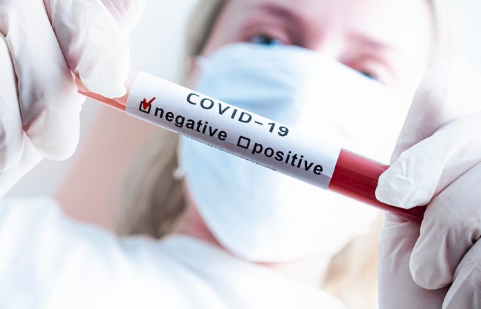 70.396 pruebas por COVID-19 negativas en colombia