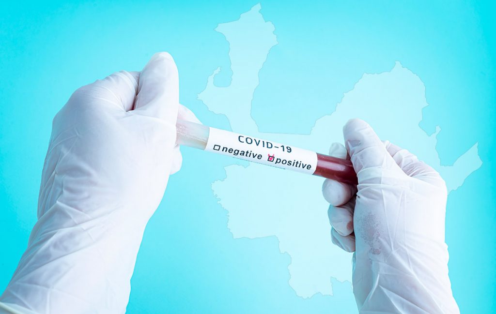Contagiados coronavirus Antioquia suma 25 nuevos casos de COVID-19 este 7 de abril —