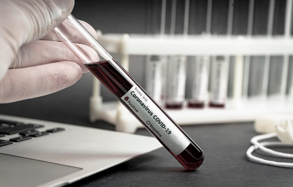 Prueba diagnostica Covid-19