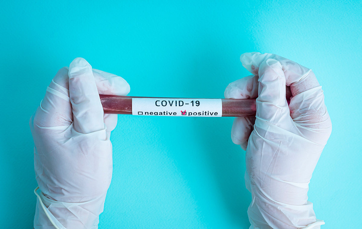 Covid-19 seroprevalencia en Medellín porcentaje de contagiado
