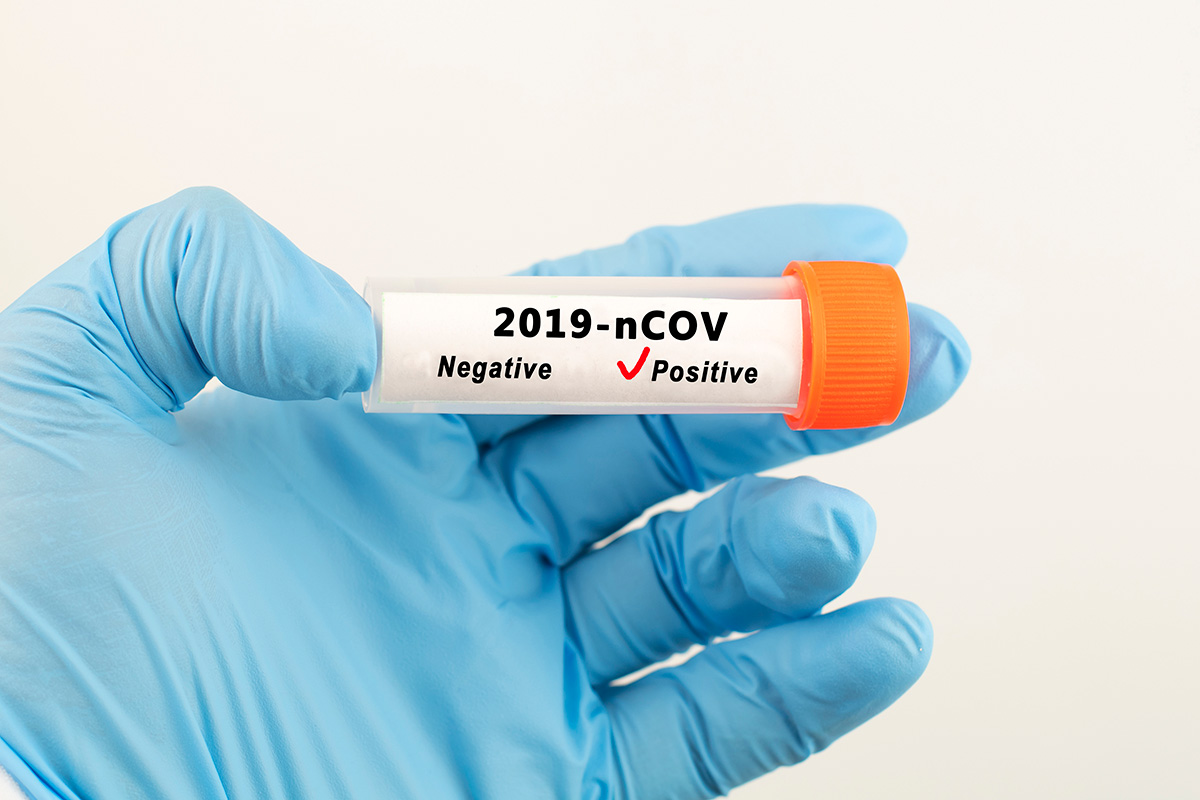 Miedo a dar positivo por coronavirus, ébola, gripe aviar, sífilis, sida o gonorrea.