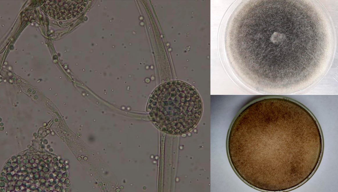Hongo Negro o Mucormicosis se encuentra en Colombia y en todo el mundo