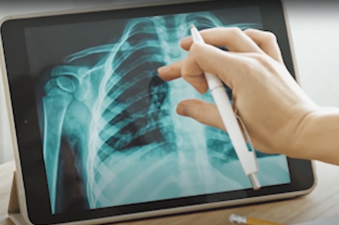 Universidades de Antioquia busca diagnosticar el COVID19 con inteligencia artificial
