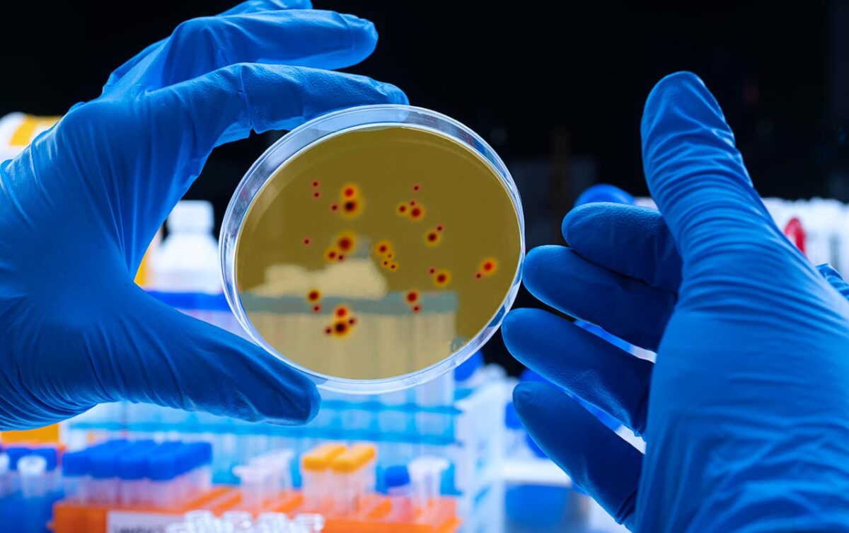 Ya la viruela del mono circula en Colombia. El Ministerio de Salud y el Instituto Nacional de Salud -INS- confirmaron tres casos de la viruela símica en el país.