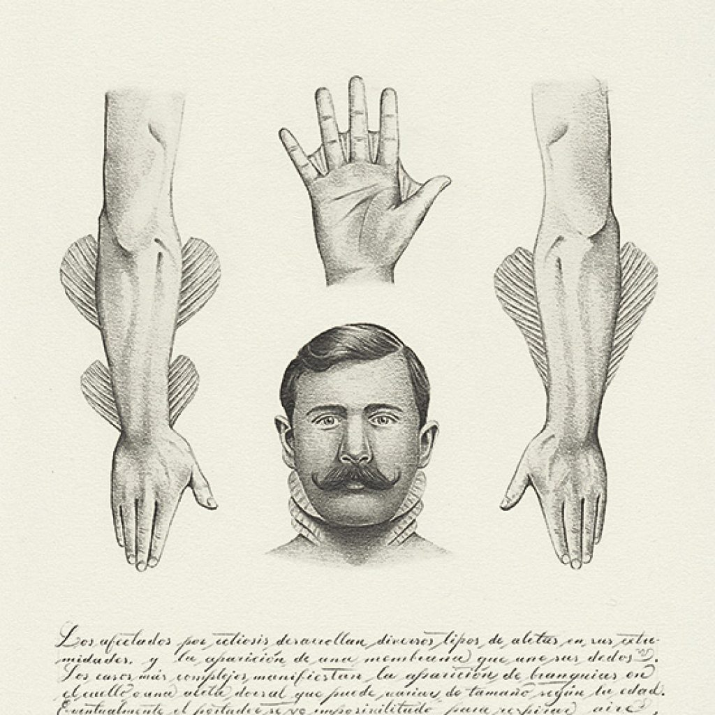 Juan Osorno. Ictiosis crónica. Lapíz sobre papel. 29,8 x 22,2 cm. 2018. Foto cortesía.