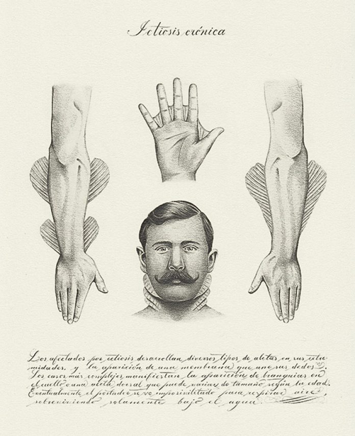 Juan-Osorno-Ictiosis-cronica Juan Osorno. Ictiosis crónica. Lapíz sobre papel. 29,8 x 22,2 cm. 2018. Foto cortesía.